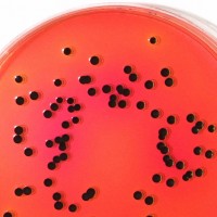 new Xylose Lysine Tergitol-4 (XLT4) Agar 